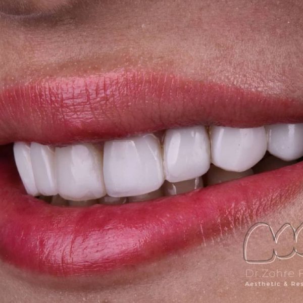 before-after-composite