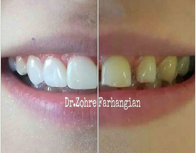 نمای قبل و بعد از از کار بیمار