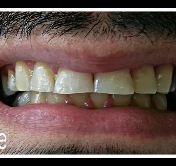 نمای قبل از کار بیمار