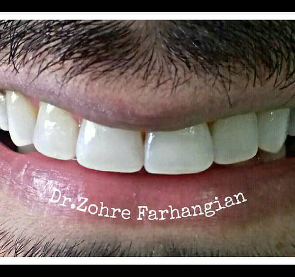 نمای بعد از کار بیمار