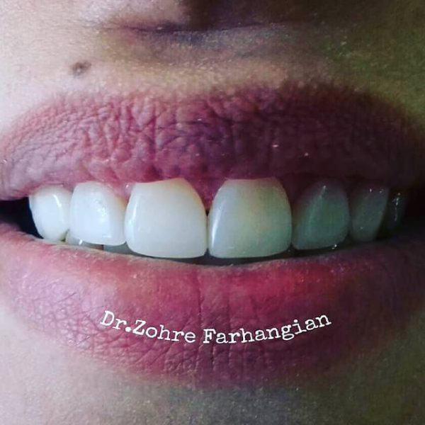 نمای بعد از از کار بیمار